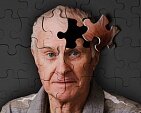 Признаки начала болезни Альцгеймера